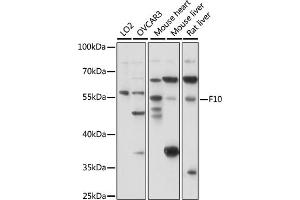 Western blot analysis of extracts of various cell lines, using F10 antibody (ABIN7266422) at 1:1000 dilution. (Coagulation Factor X Antikörper  (AA 41-300))