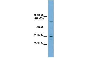 WB Suggested Anti-RPAIN Antibody Titration:  0. (RPAIN Antikörper  (C-Term))