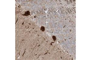 Immunohistochemical staining of human cerebellum with PUSL1 polyclonal antibody  shows strong cytoplasmic and nuclear positivity in Purkinje cells at 1:20-1:50 dilution.