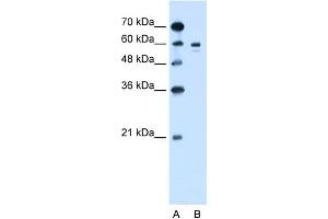 WB Suggested Anti-TYR Antibody Titration:  1. (TYR Antikörper  (Middle Region))