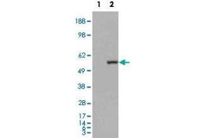 HEK293 overexpressing ALDH1A1 and probed with ALDH1A1 polyclonal antibody  (mock transfection in first lane), tested by Origene.