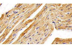 Detection of BMP2 in Rat Cardiac Muscle Tissue using Polyclonal Antibody to Bone Morphogenetic Protein 2 (BMP2) (BMP2 Antikörper  (AA 49-243))