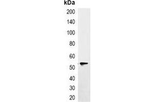 Immunoprecipitation of EYFP-tagged protein from HEK293T cells transfected with vector overexpressing EYFP tag, using Anti-EYFP-tag Antibody. (eYFP Antikörper)