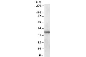 Western blot testing of human lung lysate with PDLIM1 antibody at 0. (PDLIM1 Antikörper)