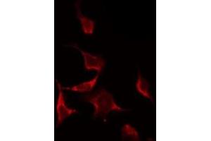 ABIN6268845 staining NIH-3T3 by IF/ICC. (NRF1 Antikörper  (Internal Region))