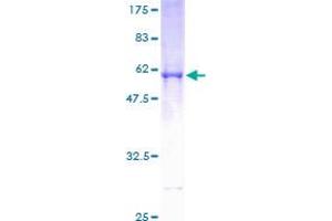 PSMG2 Protein (AA 1-264) (GST tag)