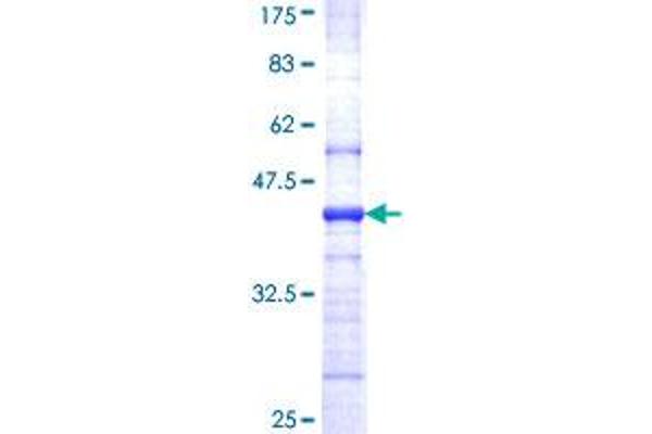 EIF4A2 Protein (AA 1-100) (GST tag)