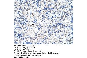 Human Liver (IKZF3 Antikörper  (N-Term))