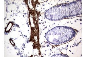 Image no. 2 for anti-Tuberous Sclerosis 1 (TSC1) (AA 836-1164) antibody (ABIN1491685) (TSC1 Antikörper  (AA 836-1164))