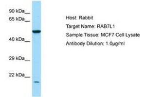 Image no. 1 for anti-RAB7, Member RAS Oncogene Family-Like 1 (RAB7L1) (N-Term) antibody (ABIN6750021)