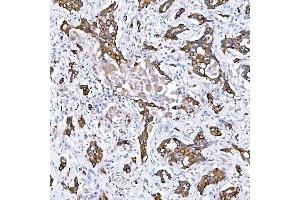 IHC analysis of Cytokeratin 4/KRT4 using anti-Cytokeratin 4/KRT4 antibody (ABIN7600283).