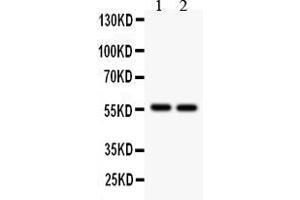 Anti- ALDH2  Picoband antibody, Western blottingAll lanes: Anti ALDH2  at 0. (ALDH2 Antikörper  (N-Term))