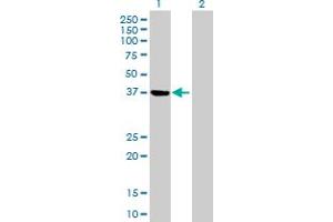 Western Blot analysis of PSAT1 expression in transfected 293T cell line by PSAT1 MaxPab polyclonal antibody. (PSAT1 Antikörper  (AA 1-370))