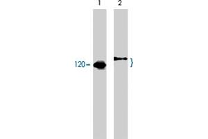 Western blot analysis of human Jurkat cells untreated (lane 1) or treated with pervanadate (1 mM) for 30 minutes (lane 2). (CBL Antikörper  (C-Term))
