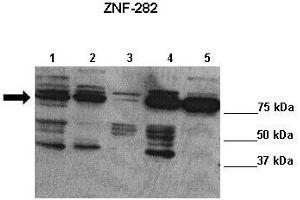 Lanes : Lane 1: 20ug Bewo cells Lane 2: 20ug HEK cells Lane 3: 20ug JEG3 cells Lane 4: 20ug PC3 cells Lane 5: 20ug SHEP cells  Primary Antibody Dilution :  1:1000   Secondary Antibody : Anti-rabbit-HRP  Secondary Antibody Dilution :  1:7500  Gene Name : ZNF282  Submitted by : Lisa Stubbs, University of Illinois (ZNF282 Antikörper  (C-Term))
