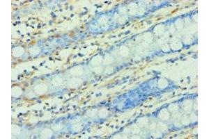 Immunohistochemistry (IHC) image for anti-Wingless-Type MMTV Integration Site Family Member 2 (WNT2) (AA 26-360) antibody (ABIN7166295)