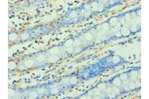 Immunohistochemistry of paraffin-embedded human colon tissue using ABIN7166295 at dilution of 1:100 (WNT2 Antikörper  (AA 26-360))