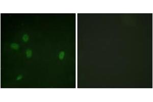 Immunofluorescence analysis of NIH-3T3 cells, using 53BP1 (Phospho-Ser25) Antibody. (TP53BP1 Antikörper  (pSer25))
