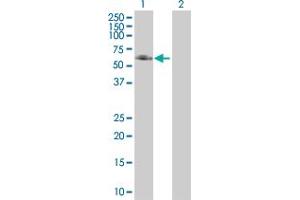 Western Blot analysis of ANGPTL3 expression in transfected 293T cell line ( H00027329-T01 ) by ANGPTL3 MaxPab polyclonal antibody. (ANGPTL3 Antikörper  (AA 1-460))