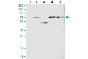 Western blot analysis of Lane 1: RT-4, Lane 2: U-251 MG, Lane 3: Human Plasma, Lane 4: Liver, Lane 5: Tonsil with GUCY1B3 polyclonal antibody  at 1:250-1:500 dilution. (GUCY1B3 Antikörper)