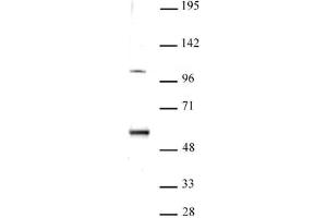 ELP3 antibody (pAb) tested by Western blot. (ELP3/KAT9 Antikörper  (N-Term))