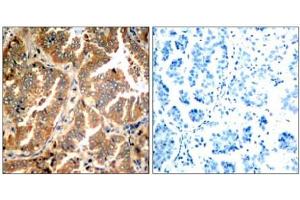 Image no. 1 for anti-Adducin 1 (Alpha) (ADD1) (Ser726) antibody (ABIN197406) (alpha Adducin Antikörper  (Ser726))