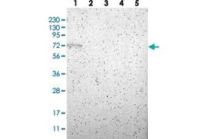 Western blot analysis of Lane 1: RT-4, Lane 2: U-251 MG, Lane 3: Human Plasma, Lane 4: Liver, Lane 5: Tonsil with RBM47 polyclonal antibody  at 1:250-1:500 dilution. (RBM47 Antikörper)