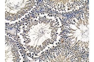 ABIN6259328 and ABIN6275301 at 1/100 staining rat testis tissue by IHC-P. (NBPF7 Antikörper  (C-Term))