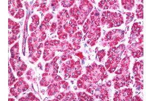 Human Pancreas: Formalin-Fixed, Paraffin-Embedded (FFPE) (ASH1L Antikörper  (AA 2919-2969))