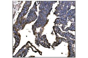 IHC analysis of IGF2R using anti-IGF2R antibody (ABIN7601705). (IGF2R Antikörper  (AA 424-529))