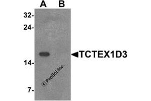 Western Blotting (WB) image for anti-T-Complex-Associated-Testis-Expressed 3 (TCTE3) (N-Term) antibody (ABIN1587949)