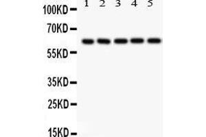 SHC1 Antikörper  (C-Term)