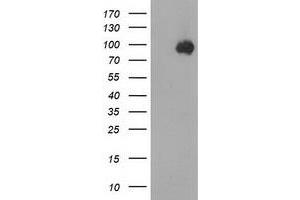 HEK293T cells were transfected with the pCMV6-ENTRY control (Left lane) or pCMV6-ENTRY CTNNB1 (Right lane) cDNA for 48 hrs and lysed. (CTNNB1 Antikörper)