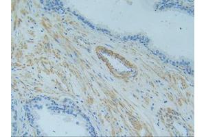 IHC-P analysis of Human Prostate Gland Tissue, with DAB staining. (TNFRSF1A Antikörper  (AA 60-236))