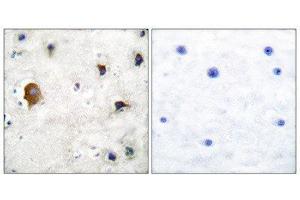 Immunohistochemistry (IHC) image for anti-Gap Junction Protein, alpha 1, 43kDa (GJA1) (C-Term) antibody (ABIN1848481) (Connexin 43/GJA1 Antikörper  (C-Term))