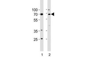 p73 antibody western blot analysis in 1) human K562 cell line and 2) mouse brain tissue lysate.