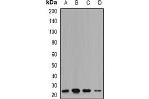 Western blot analysis of mPR expression in HepG2 (A), SW480 (B), mouse liver (C), mouse brain (D) whole cell lysates. (mPR Antikörper)
