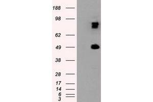 Western Blotting (WB) image for anti-Proteasome (Prosome, Macropain) 26S Subunit, ATPase, 3 (PSMC3) antibody (ABIN1501328) (PSMC3 Antikörper)