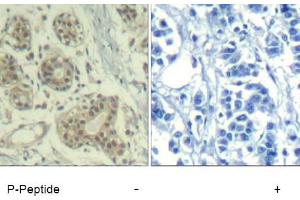 Image no. 1 for anti-Mdm2, p53 E3 Ubiquitin Protein Ligase Homolog (Mouse) (MDM2) (pSer166) antibody (ABIN401610) (MDM2 Antikörper  (pSer166))