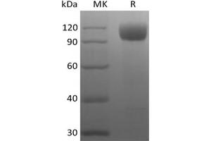 Western Blotting (WB) image for Angiotensin I Converting Enzyme 2 (ACE2) (Active) protein (His tag) (ABIN7321043) (ACE2 Protein (His tag))