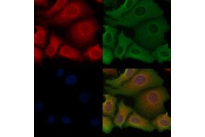 ABIN6254917 and ABIN6267068 staining Hela cells by IF/ICC. (alpha-SMA (N-Term) Antikörper)