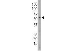 Image no. 1 for anti-Sialic Acid Binding Ig-Like Lectin 6 (SIGLEC6) (C-Term) antibody (ABIN357146) (SIGLEC6 Antikörper  (C-Term))