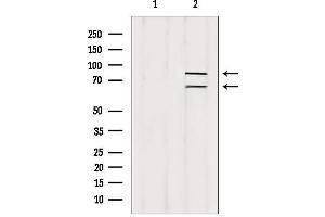 Western blot analysis of extracts from rat spleen, using Melanophilin antibody. (Melanophilin Antikörper  (C-Term))