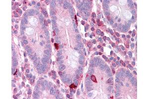 Immunohistochemistry (IHC) image for anti-Eukaryotic Translation Elongation Factor 2 (EEF2) (N-Term) antibody (ABIN2787690) (EEF2 Antikörper  (N-Term))