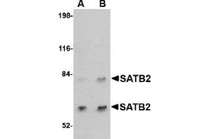 Western Blotting (WB) image for anti-SATB Homeobox 2 (SATB2) (C-Term) antibody (ABIN1030643) (SATB2 Antikörper  (C-Term))