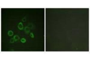 Immunofluorescence analysis of LOVO cells, using Bax (Ab-167) antibody. (BAX Antikörper  (Thr167))