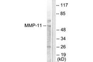Western blot analysis of extracts from A549 cells, using MMP-11 Antibody.