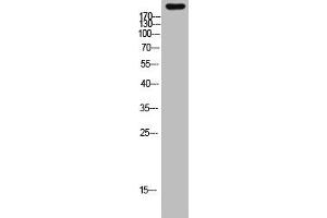 Western Blot analysis of mouse-heart cells using primary antibody diluted at 1:2000(4 °C overnight). (MYH6 Antikörper  (AA 341-390))