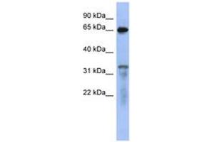 Image no. 1 for anti-RAP1 GTPase Activating Protein (RAP1GAP) (AA 503-552) antibody (ABIN6744090) (RAP1GAP Antikörper  (AA 503-552))