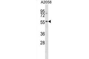 Western Blotting (WB) image for anti-BTB (POZ) Domain Containing 14A (BTBD14A) antibody (ABIN2998943) (BTBD14A Antikörper)